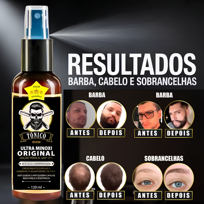 Minoxidil 15% D'Lust Turbo 120ml, para Cabelo, Barba e Sobrancelha