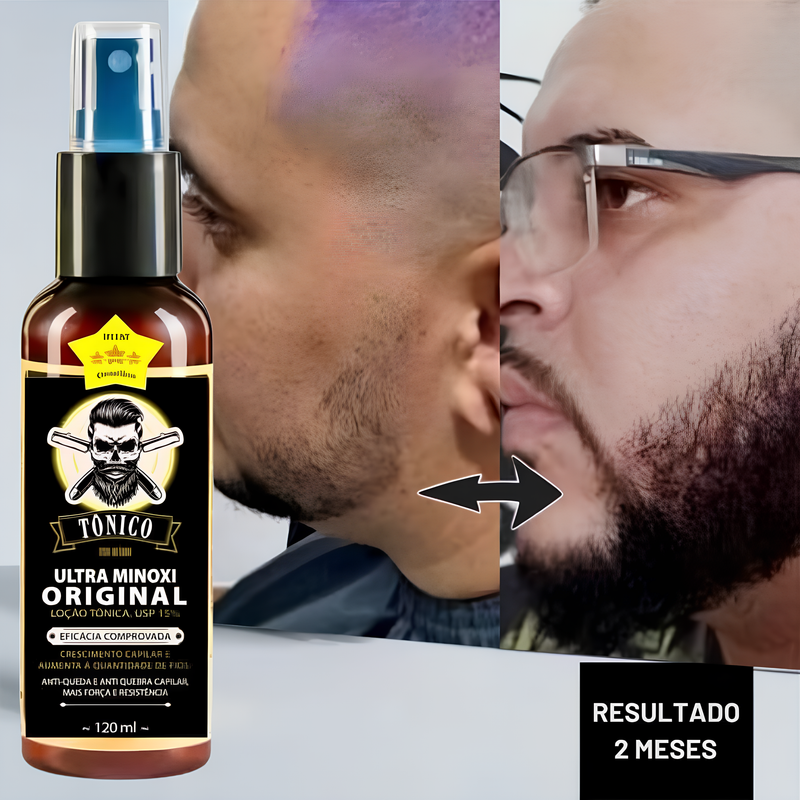 Minoxidil 15% D'Lust Turbo 120ml, para Cabelo, Barba e Sobrancelha