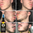 Minoxidil 15% D'Lust Turbo 120ml, para Cabelo, Barba e Sobrancelha